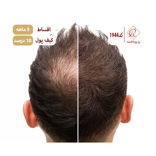 مرکز تخصصی درمان مو بیتا بانو